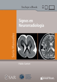 SIGNOS EN NEURORRADIOLOGIA