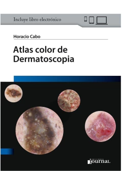ATLAS COLOR DE DERMATOSCOPIA