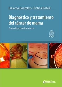 DIAGNOSTICO Y TRATAMIENTO DEL CANCER DE MAMA