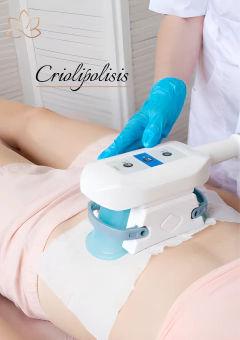 Criolipolisis de succión