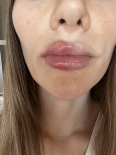 Lip Plumper Clear Pink- Volumen EXTREMO - Milenka Cosmetics