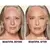 Charlotte Tilbury | Beautiful Skin Medium to Full Coverage Radiant Concealer with Hyaluronic Acid en internet