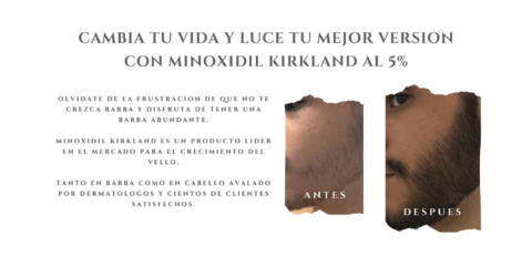Carrusel 1