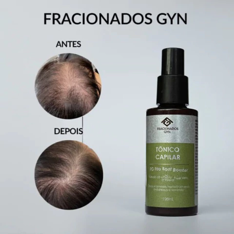 Tônico Capilar FG Root Booster 120ml – Cuidado Diário com Aloe, Chlorella e Óleos Essenciais