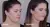 Corrector ACNE en internet