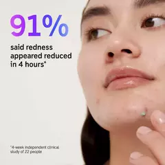 Imagen de Succinic Acid Acne Treatment - The Inkey List