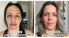 Sérum MELASMA - 20ml - NOVA EMBALAGEM na internet