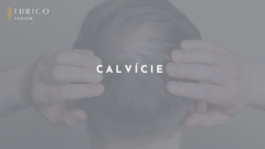 Banner da categoria CALVÍCIE