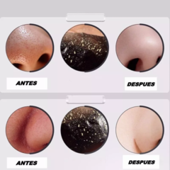SKINCARE PACK: PARCHES PARA OJERAS COLAGENO + MÁSCARAS ANTI-ACNÉ (X10) - ShoppeAR