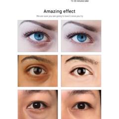 SKINCARE PACK: PARCHES PARA OJERAS COLAGENO + MÁSCARAS ANTI-ACNÉ (X10) - ShoppeAR