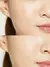 Parches Acne Pimple Patch Cosrx en internet