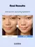 Suero Hyaluronic Acid 3% Cosrx - Flawless Store