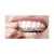 Imagem do Moldeira Para Clareamento Dental Superior Inferior + Porta Moldeira
