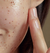 HANYUL Soft Chestnut Sebum Controlling Pore Clay Pack 100mL (Argila Esfoliante para Poros) - SDK STORE