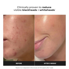 PAULA’S CHOICE - MINI SKIN PERFECTING 2% BHA EXFOLIATING TONER FOR CLEAR SKIN - comprar online