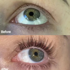 FORCHICS - EYELASH GROWTH SERUM en internet