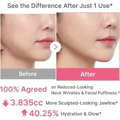 MEDICUBE - PDRN Collagen Gua Sha Neck Wrinkle Cream - CYM STORE