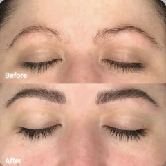 FORCHICS - EYEBROW GROWTH SERUM - CYM STORE