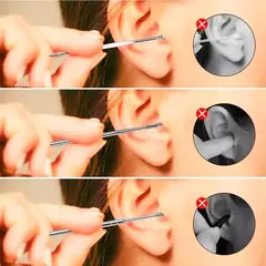 KIT DE LIMPIEZA DE OIDOS PROFESIONAL 6 EN 1 / REUTILIZABLES - Martshoparg