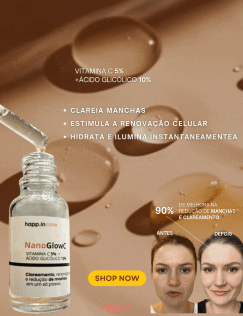 Carrossel 1