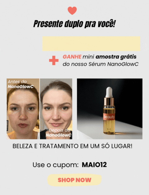 Carrossel 1
