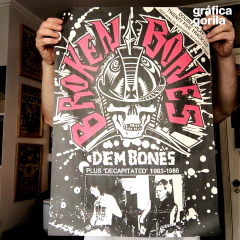 BROKEN BONES - Dem Bones