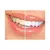 Clareador Dental Whiteness Simple 22% - 12 Unidades - FGM - Clareador Dental - Buran Cosméticos
