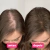 Imagem do RAIZ TROPICAL SPRAY COMPRE 2 LEVE 3 | Tratamento para 3 meses