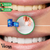 X10! Tiras blanqueadoras dentales en internet
