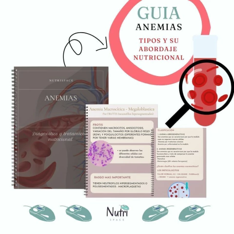 Guía ANEMIAS - Tipos y abordaje nutricional.