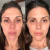 Imagen de Sistema de Entrenamiento Facial CHILOFT Beauty – Desafío Lift & Glow (Curso Online de 21 días)