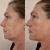 Sistema de Entrenamiento Facial CHILOFT Beauty – Desafío Lift & Glow (Curso Online de 21 días) - tienda online