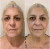 Sistema de Entrenamiento Facial CHILOFT Beauty – Desafío Lift & Glow (Curso Online de 21 días) - Chiloft Beauty