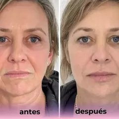 MascaraBioColagen™ - Máscarilla de Colágeno con Efecto Rejuvenecedor -PACK 3x1 por Tiempo Limitado! - ENVIO GRATIS - Audaces