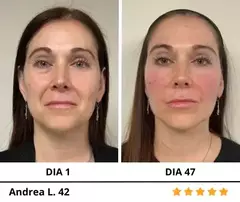 Face Glow™ - Audaces