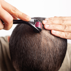Dermaroller 1.5mm para Capilar y Barba - comprar online