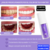 Blanqueador Dental V34™ - TRENDFINDER® (2024) - comprar online