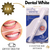 ¡PROMO 3x1! Lápiz Blanqueador Dental White - PREMIUM SHOP