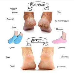 TORNO AMOPE + MAS MEDIAS DE HIDROGEL + 50% OFF - NOVA SHOPP