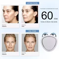 "Skin-ion™ | Lifting Facial Instantáneo con Microcorriente Reafirmante"