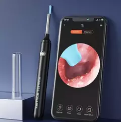 OtoScope+® - Limpiador de oído cámara 4k