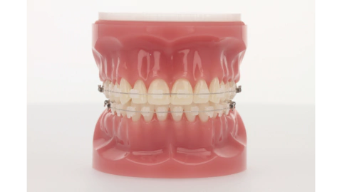 Caso 20/40 CERAMIC (Porcelana-Ceramico) - comprar online