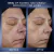 Lancôme Génifique Ultimate Dual Recovery Face Serum- Anti-Aging Serum Visibly Improves Fine Lines, Rough Texture, Plumpness and Even Skintone - with Beta Glucan and, Hyaluronic Acid - Cosmfinity