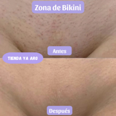 Depiladora Ya™ 2x1 - Exfoliante Sin Dolor - Tienda Ya