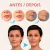 Adesivos Anti Rugas para Rosto Modelo:5 Peças (Rosto-5)