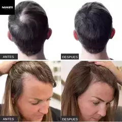 Kit Anti-Caida KIRKLAND - 2X1 en Minoxidil 5% + Rodillo DE REGALO! (Incluye Gotero para aplicar) - Royal Flash