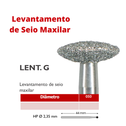 LEVANTAMENTO DE SEIO MAXILAR LENTILHA