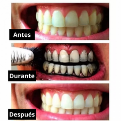 Blanqueador Dental - HOUSY HOGAR