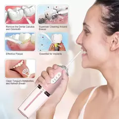 Irrigador Dental