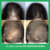 KIT ANTI CALVICIE® | 3 Lociones Capilares Anticaída - tienda online